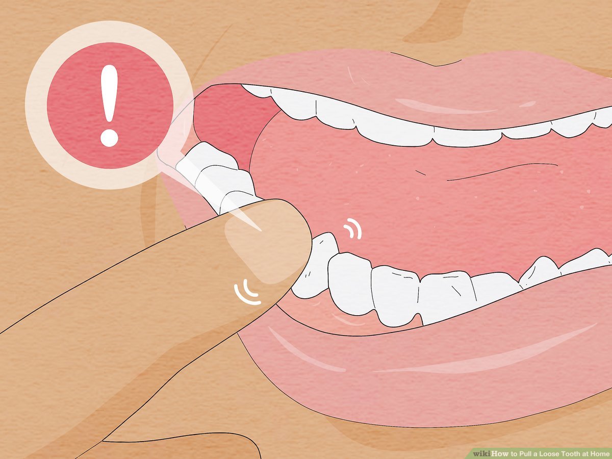 Tooth Extraction at Home: Safety Concerns and Alternative Options